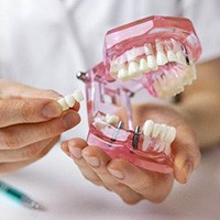 Dentist holding model of teeth with implant bridge