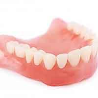 an example of a traditional full denture